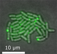 Mikroskop-billede af bakterier