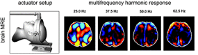 Måling af hjerneaktivitet med NMR-scanner