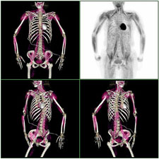 PET-scans of humans